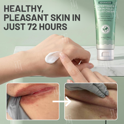 Limited Stock!!⚡AEXZR® Advanced Intertrigo & Skin Fold Relief Cream