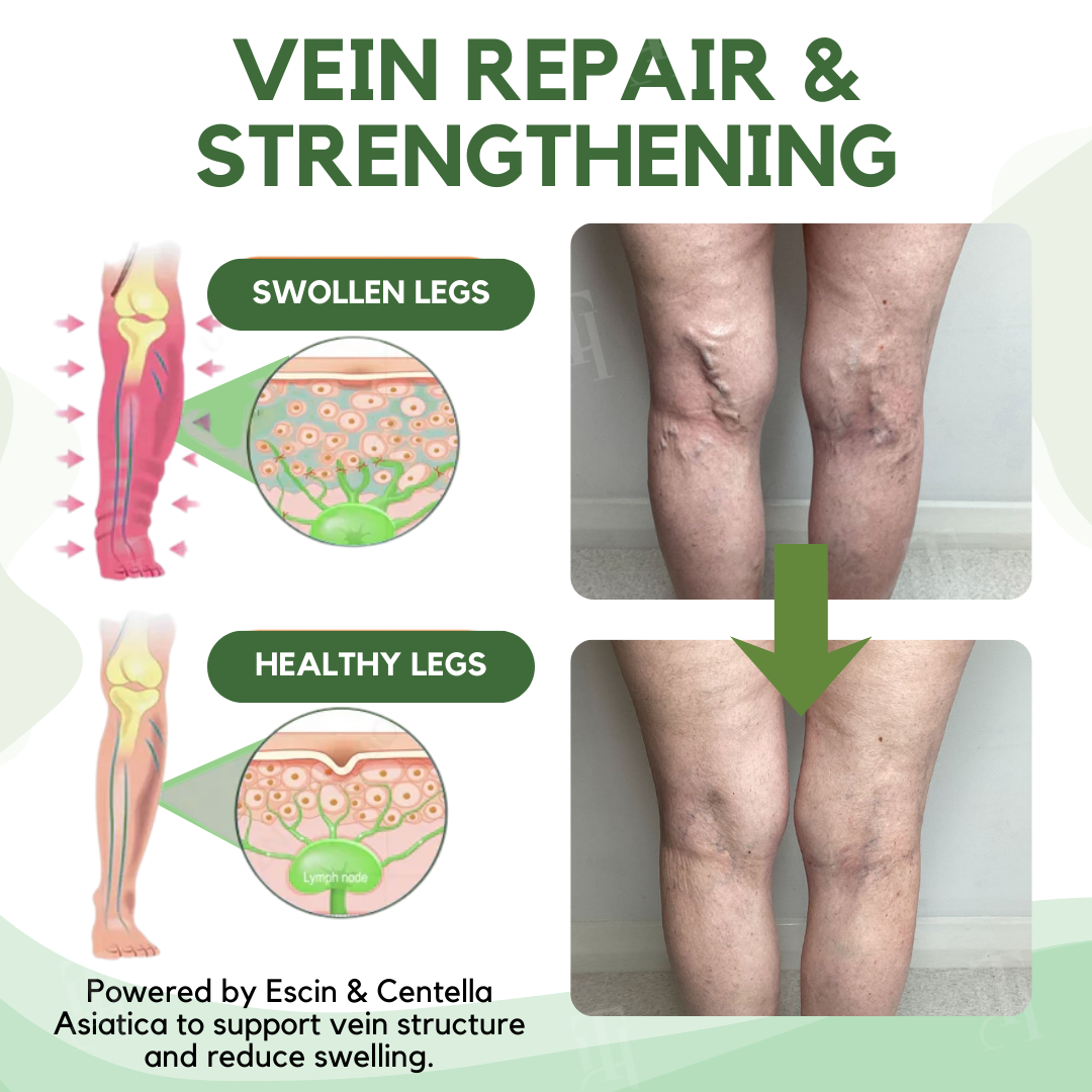 Limited Stock!!⚡RZXEA™ Next-Gen Lymphatic Drainage & Vein Repair Cream