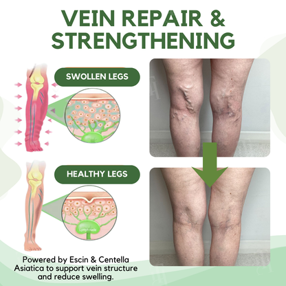 Limited Stock!!⚡RZXEA™ Next-Gen Lymphatic Drainage & Vein Repair Cream