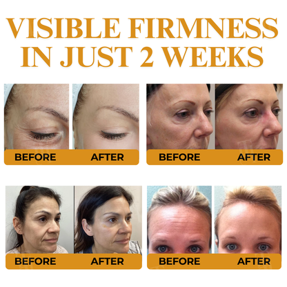 AEXZR® Letybo Bee Venom Wrinkle Removal Cream