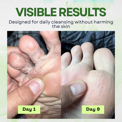 🔥 FLASH SALE: 50% OFF! | Cvreoz® Spore Defense Relief Soap Bar