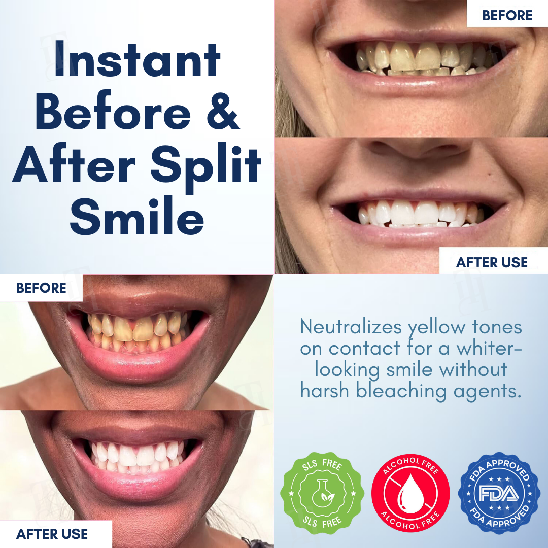 AEXZR® Pro-Bright Teeth Gloss - Instant Radiant Smile