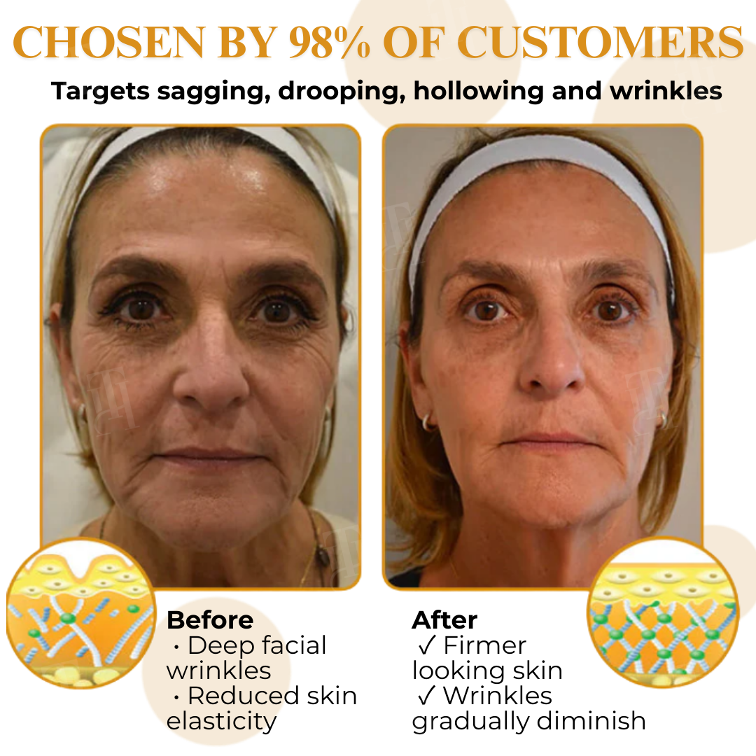 AEXZR® Letybo Bee Venom Wrinkle Removal Cream