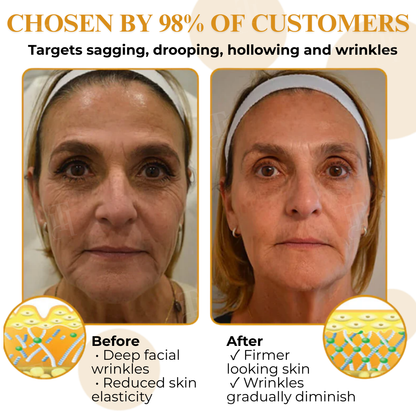 AEXZR® Letybo Bee Venom Wrinkle Removal Cream