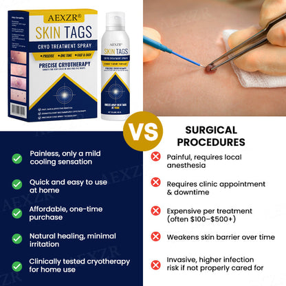AEXZR® Skin Tag Cryo Treatment Spray