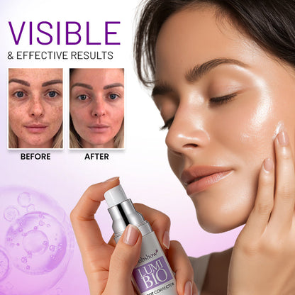 🎉EXCLUSIVE OFFER: HALF PRICE! | Dobshow® Lumi-Bio Spot Corrector