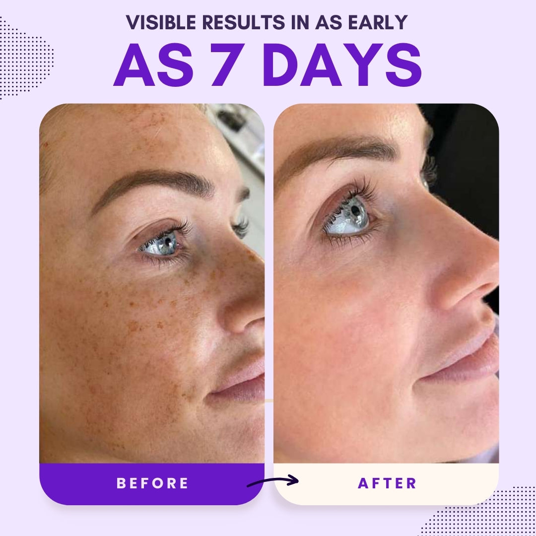 AEXZR® Thiamidol 630 Serum